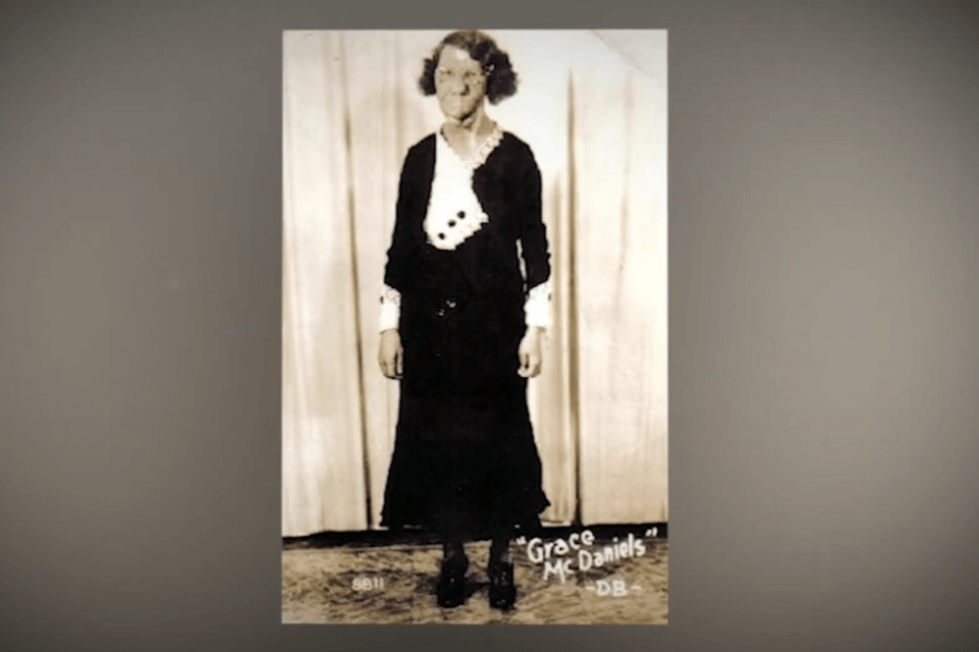 Sepia-toned portrait of Grace McDaniels, a woman with a pronounced facial disfigurement due to a rare condition known as Sturge-Weber syndrome. She stands in front of a curtain, wearing a dark dress with white cuffs and buttons, her hands relaxed at her sides. Known as the "Mule-Faced Woman" in exploitative sideshow advertising, Grace is now remembered as a mother and performer who lived with dignity despite widespread public objectification.
