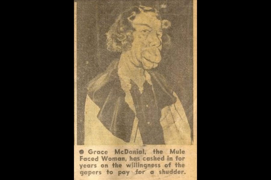 A vintage newspaper clipping featuring Grace McDaniels, a woman with a severe facial deformity caused by Sturge-Weber syndrome. The yellowed image shows her wearing a dark blouse with a light collar, her face visibly affected by her condition. The original caption, which uses exploitative and sensationalist language, reflects how people with disabilities were historically objectified for public entertainment.