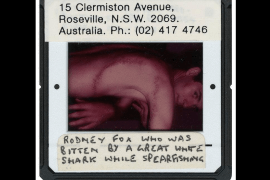 Slide photo labeled with an Australian address shows Rodney Fox, shirtless and turned to display a large, curved scar stretching from his chest around to his back—the aftermath of a great white shark bite suffered while spearfishing. Handwritten text on the slide reads: "Rodney Fox who was bitten by a great white shark while spearfishing."