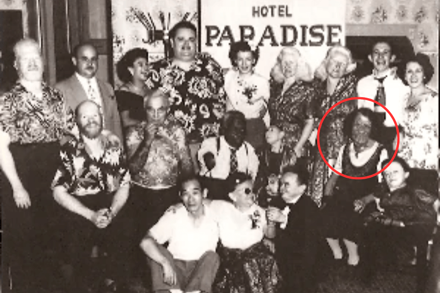 Black and white group photo of sideshow performers and entertainers gathered under a “Hotel Paradise” banner, many smiling and dressed in patterned clothing. The woman circled on the right is Grace McDaniels, identifiable by her facial disfigurement associated with Sturge-Weber syndrome. This candid moment reflects solidarity and shared life among performers who often lived on the fringes of mainstream society.