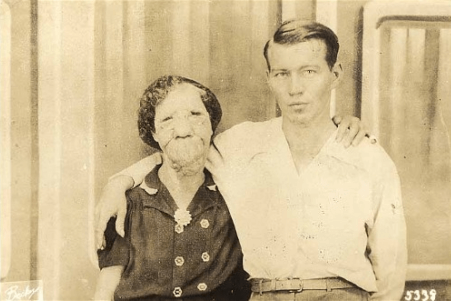 Sepia-toned portrait of Grace McDaniels, a woman with a severe facial deformity caused by Sturge-Weber syndrome, standing with her arm around a young man—likely her son Elmer. She wears a dark dress with decorative buttons and a brooch, while he wears a light shirt tucked into belted trousers. Their embrace and solemn expressions convey a quiet bond and mutual care beyond the spectacle of Grace’s former sideshow career.