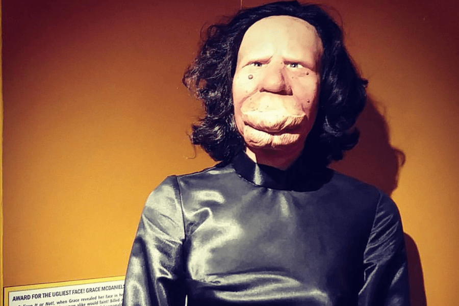 Lifelike museum figure depicting Grace McDaniels, a woman known for her facial disfigurement caused by Sturge-Weber syndrome, shown here with exaggerated features including a large lower face and lips. The figure wears a shiny black garment and is displayed against a yellow-orange wall. A visible placard below refers to an outdated and offensive label once used in her promotion, underscoring the historical exploitation of people with disabilities.