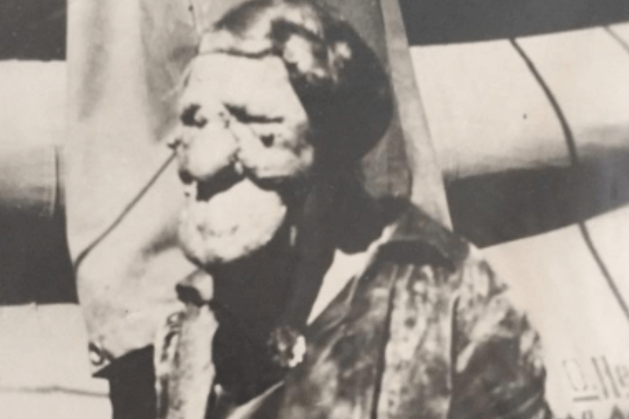 Black and white photograph of Grace McDaniels, a woman with a severe facial deformity caused by Sturge-Weber syndrome. She is dressed in a dark outfit with a brooch and appears to be seated, possibly outdoors or near a performance tent. Her profile is captured in soft focus, offering a contemplative look at a woman who was publicly labeled for her appearance but privately known for her resilience and quiet dignity.