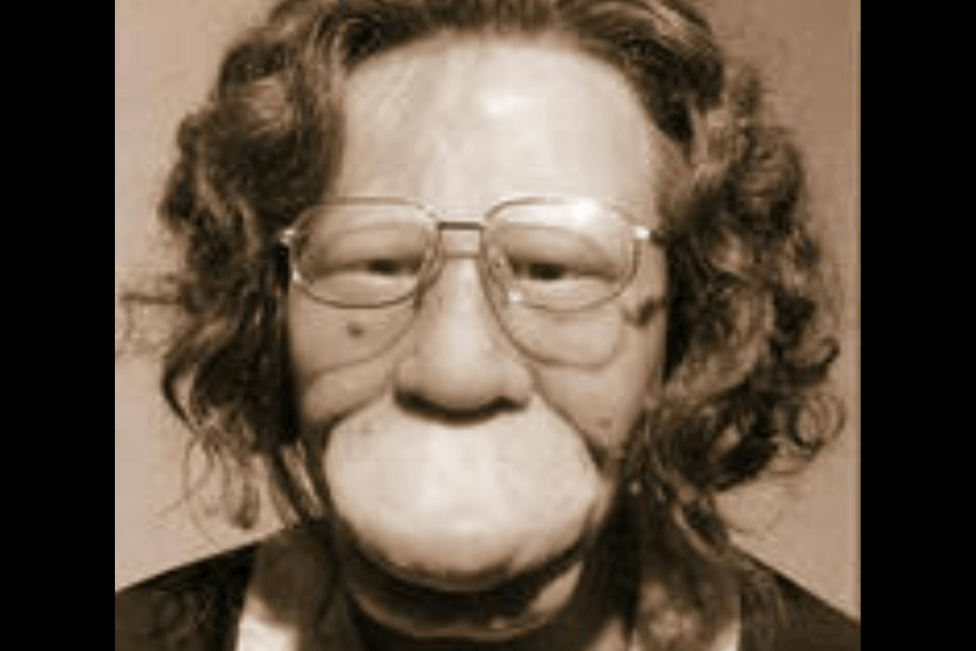 Sepia-toned close-up of a wax figure or sculptural representation of Grace McDaniels, a woman who lived with severe facial disfigurement caused by Sturge-Weber syndrome. The figure has curly hair, wears large eyeglasses, and has exaggerated features that reflect how she was portrayed in sideshow culture. The expression is neutral, and the soft lighting creates a somber, reflective tone.