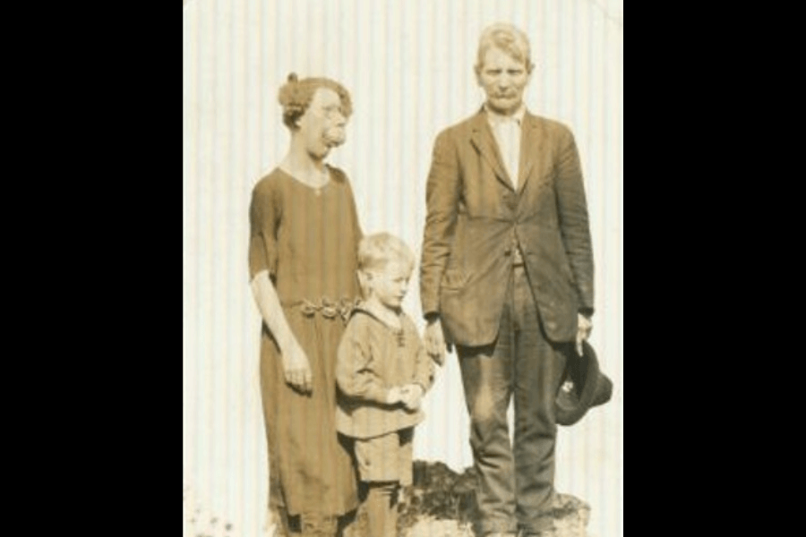 Sepia-toned portrait of a family of three standing outdoors against a light background. The woman on the left, believed to be Grace McDaniels, displays a pronounced facial disfigurement likely caused by Sturge-Weber syndrome. She stands beside a young boy and a man in a suit holding a hat, possibly her husband and son. The moment, though posed, captures a quiet strength and familial bond often overshadowed by public spectacle.