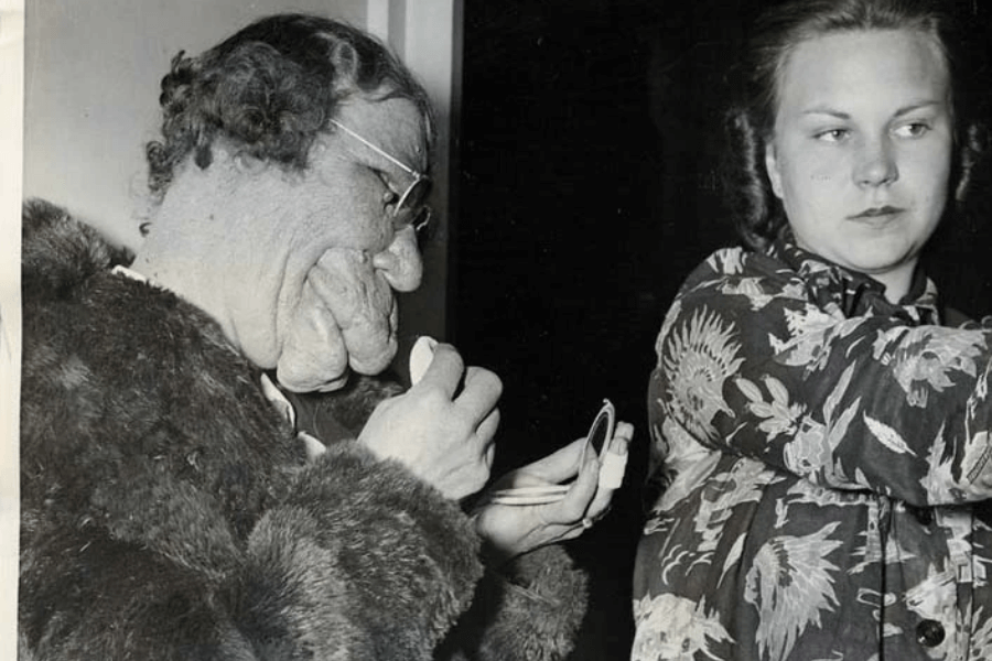 Black and white photo of two women; one on the left with a significant facial deformity is seen holding a compact mirror and applying makeup, dressed in a fur coat and glasses. The woman on the right, with a neutral expression, looks away while adjusting her sleeve. The moment captures themes of dignity, self-expression, and social contrast in the face of visible difference.