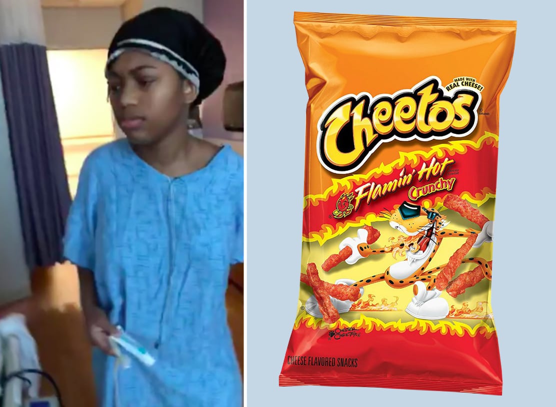 hot cheetos bad for you