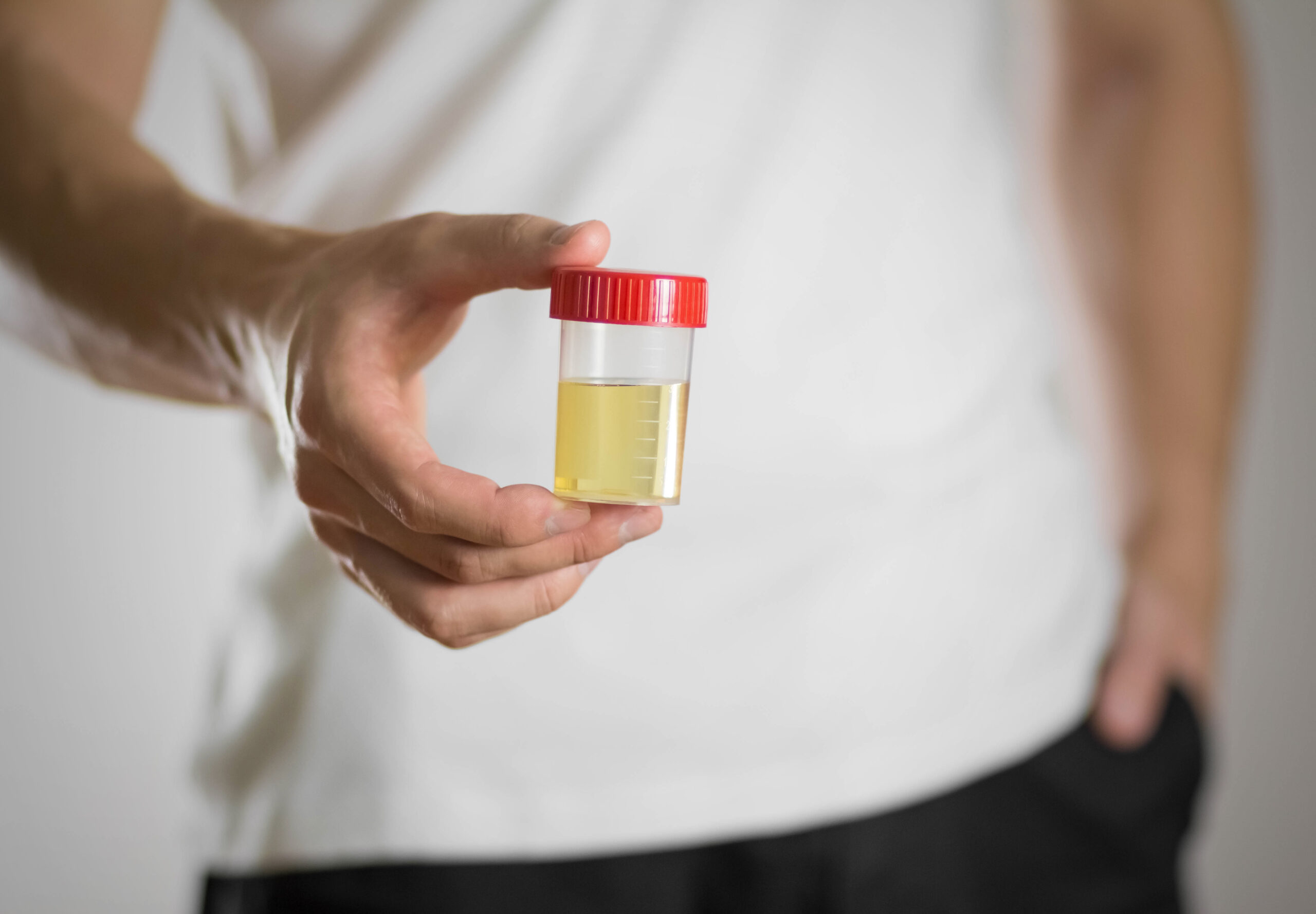 A man holds a jar with a urine test. Close up.