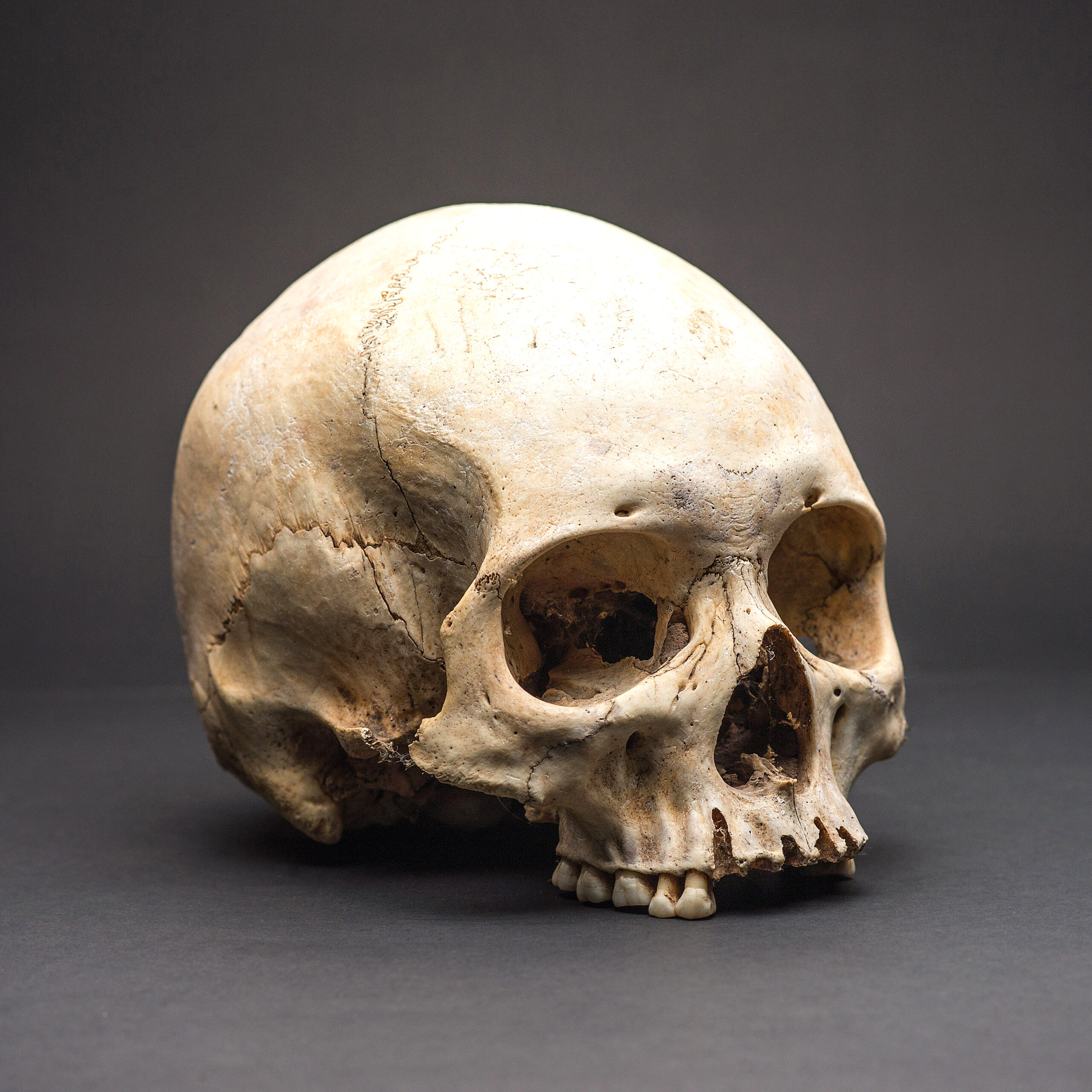 HUMAN SKULL OF PERUVIAN ANCESTORS