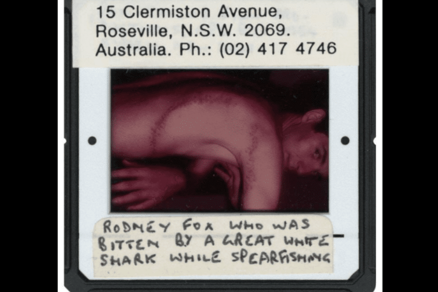 Slide photo labeled with an Australian address shows Rodney Fox, shirtless and turned to display a large, curved scar stretching from his chest around to his back—the aftermath of a great white shark bite suffered while spearfishing. Handwritten text on the slide reads: "Rodney Fox who was bitten by a great white shark while spearfishing."