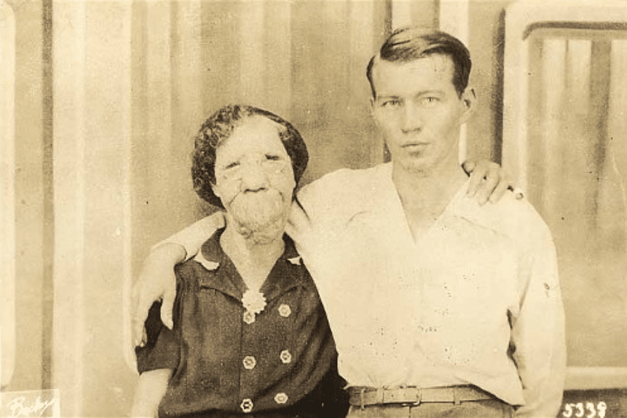 Sepia-toned portrait of Grace McDaniels, a woman with a severe facial deformity caused by Sturge-Weber syndrome, standing with her arm around a young man—likely her son Elmer. She wears a dark dress with decorative buttons and a brooch, while he wears a light shirt tucked into belted trousers. Their embrace and solemn expressions convey a quiet bond and mutual care beyond the spectacle of Grace’s former sideshow career.