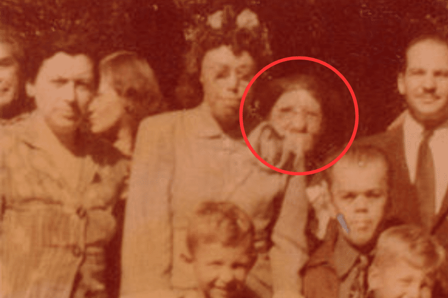Vintage color photograph of a group of people posing together, with a red circle highlighting a woman near the center who has significant facial deformities. Her condition, possibly related to a genetic disorder or untreated illness, stands in stark contrast to the rest of the smiling group—underscoring historical neglect and the visibility of difference within mainstream society.