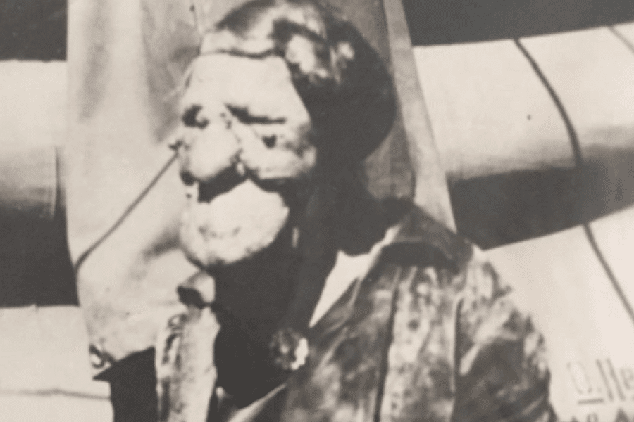 Black and white photograph of Grace McDaniels, a woman with a severe facial deformity caused by Sturge-Weber syndrome. She is dressed in a dark outfit with a brooch and appears to be seated, possibly outdoors or near a performance tent. Her profile is captured in soft focus, offering a contemplative look at a woman who was publicly labeled for her appearance but privately known for her resilience and quiet dignity.