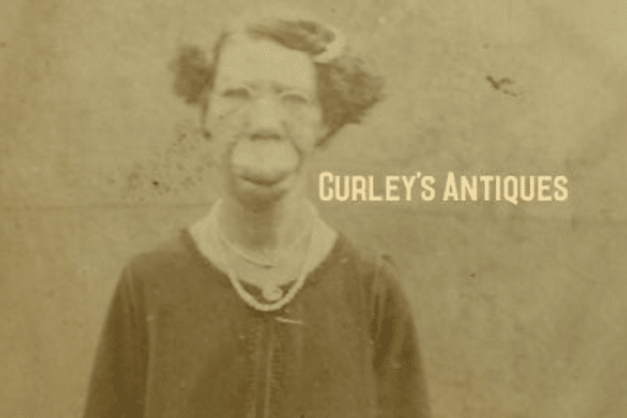 Sepia-toned portrait of Grace McDaniels, a woman with a prominent facial disfigurement caused by Sturge-Weber syndrome. She wears a dark dress with a light collar and a string of pearls, standing against a plain studio backdrop. The watermark “Curley’s Antiques” appears across the image, indicating it is part of a vintage or resale archive. The portrait captures both her visibility and dignity amid a history of public exhibition.