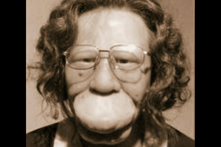 Sepia-toned close-up of a wax figure or sculptural representation of Grace McDaniels, a woman who lived with severe facial disfigurement caused by Sturge-Weber syndrome. The figure has curly hair, wears large eyeglasses, and has exaggerated features that reflect how she was portrayed in sideshow culture. The expression is neutral, and the soft lighting creates a somber, reflective tone.