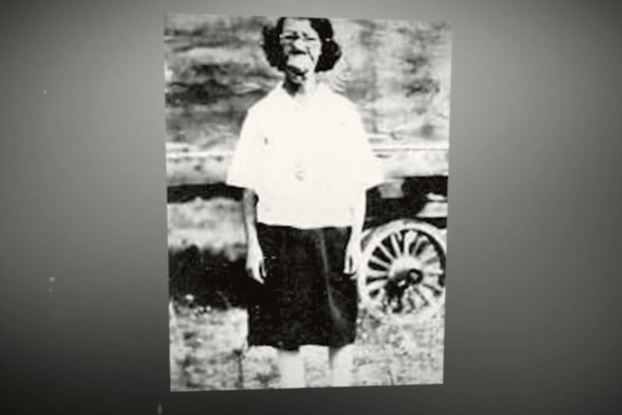 Black and white photo of a woman standing outdoors, wearing a white blouse and dark skirt, with a noticeable facial deformity that suggests a possible congenital or medical condition. Behind her is a wagon wheel, evoking a rural or early 20th-century setting, emphasizing the historical marginalization of individuals with visible differences.