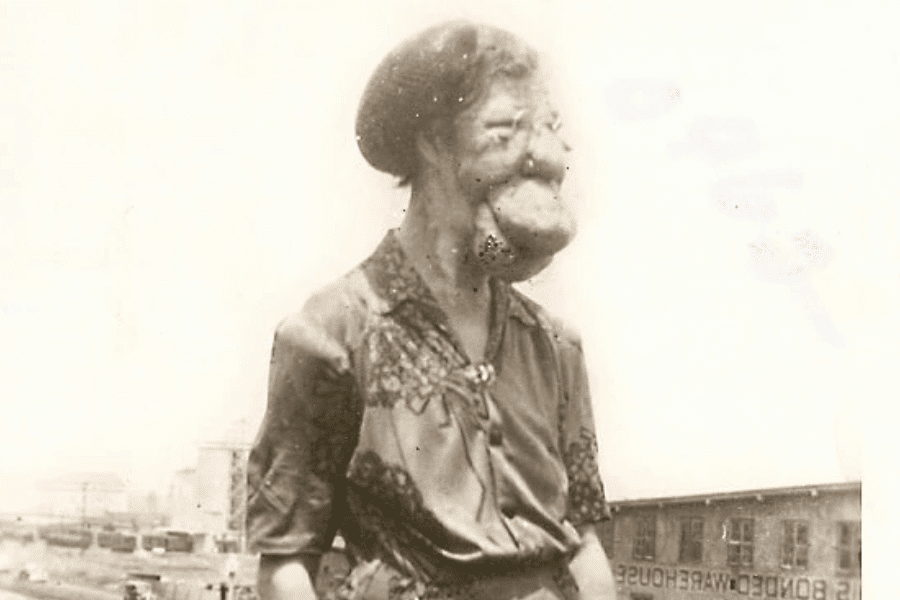 Sepia-toned photograph of Grace McDaniels standing in profile, wearing a patterned blouse with lace detail and a brooch. Her facial disfigurement, caused by Sturge-Weber syndrome, is visible. She appears composed and calm, standing against a faint urban-industrial background with signage partially reading “BONDED WAREHOUSE.” The image powerfully captures her dignity despite a life lived under public scrutiny.
