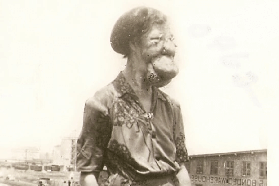 Sepia-toned photograph of Grace McDaniels standing in profile, wearing a patterned blouse with lace detail and a brooch. Her facial disfigurement, caused by Sturge-Weber syndrome, is visible. She appears composed and calm, standing against a faint urban-industrial background with signage partially reading “BONDED WAREHOUSE.” The image powerfully captures her dignity despite a life lived under public scrutiny.