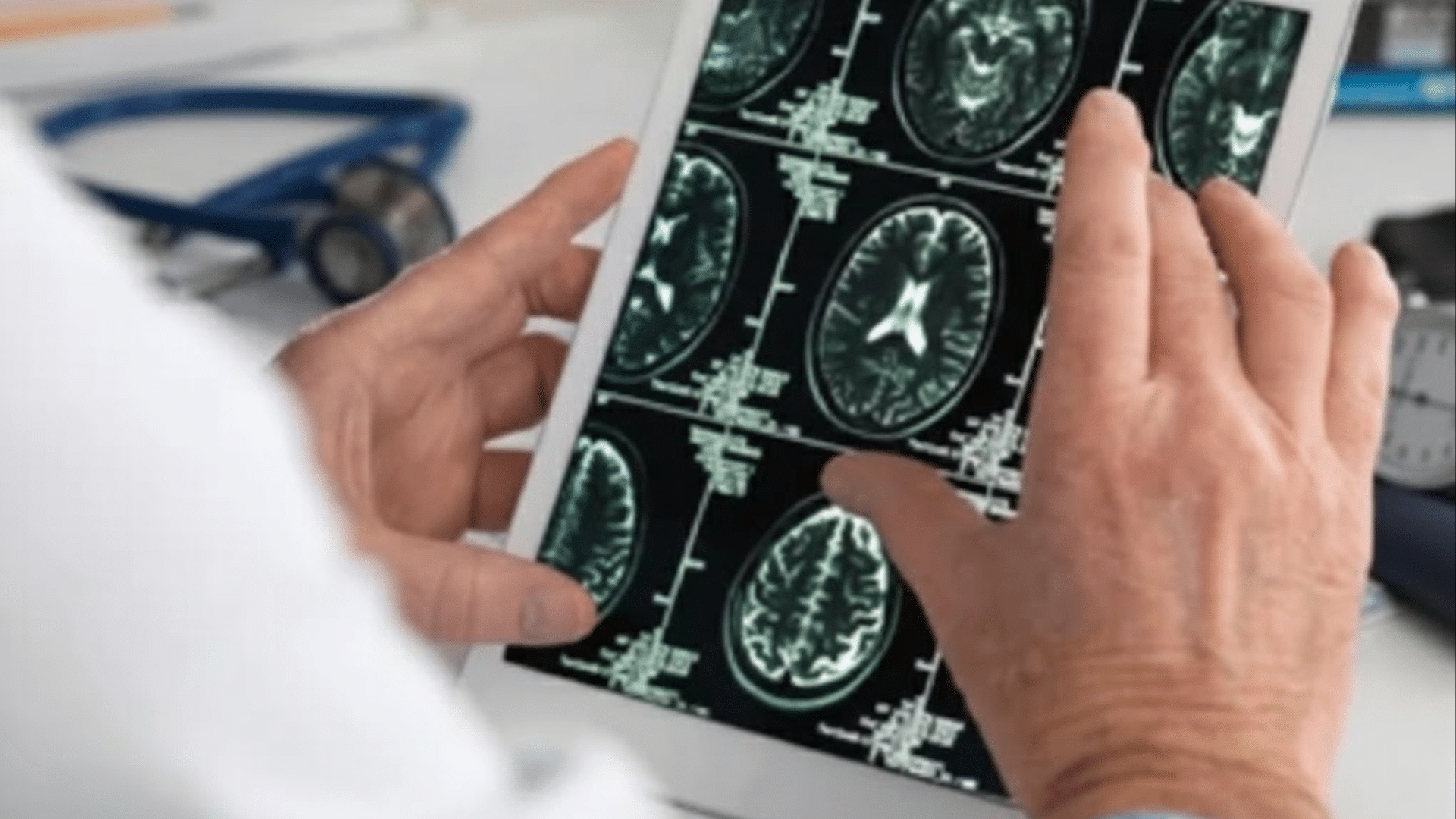 Doctor looking at brain scan images on a tablet.