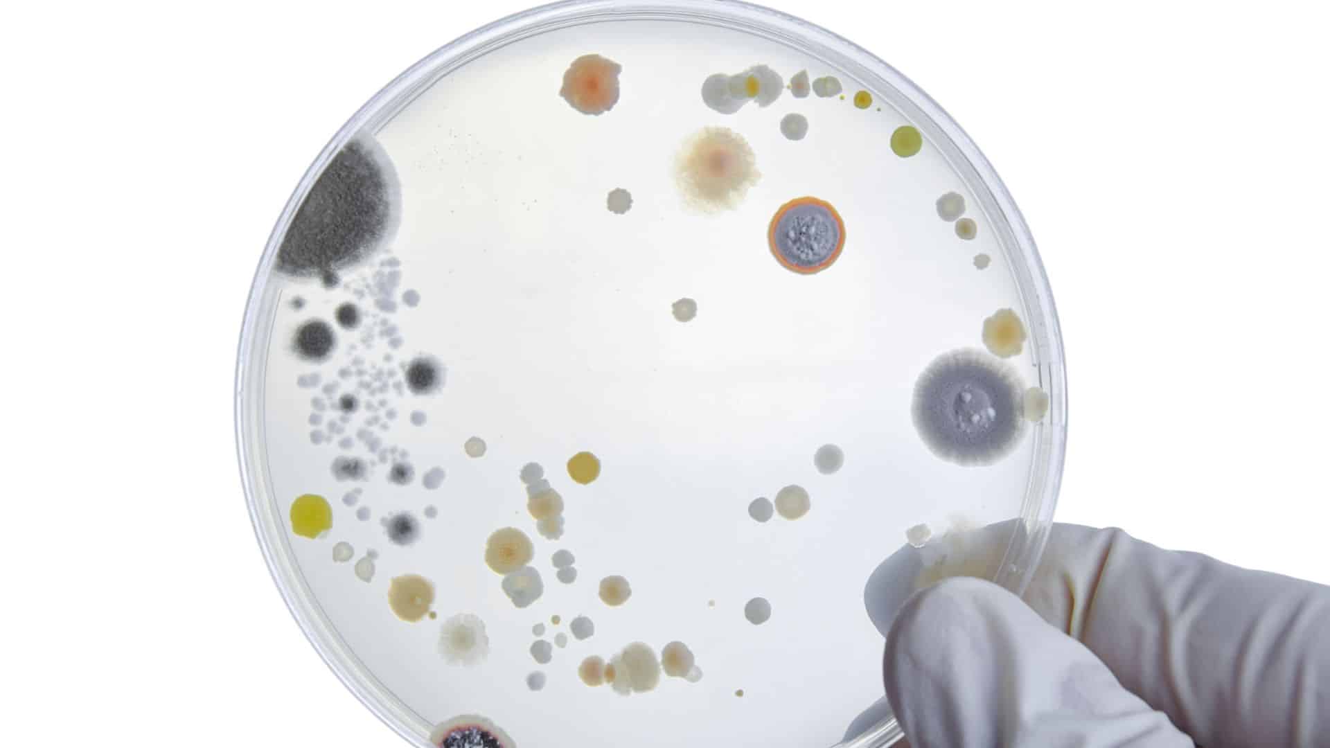 Bacteria cultures on petri dish