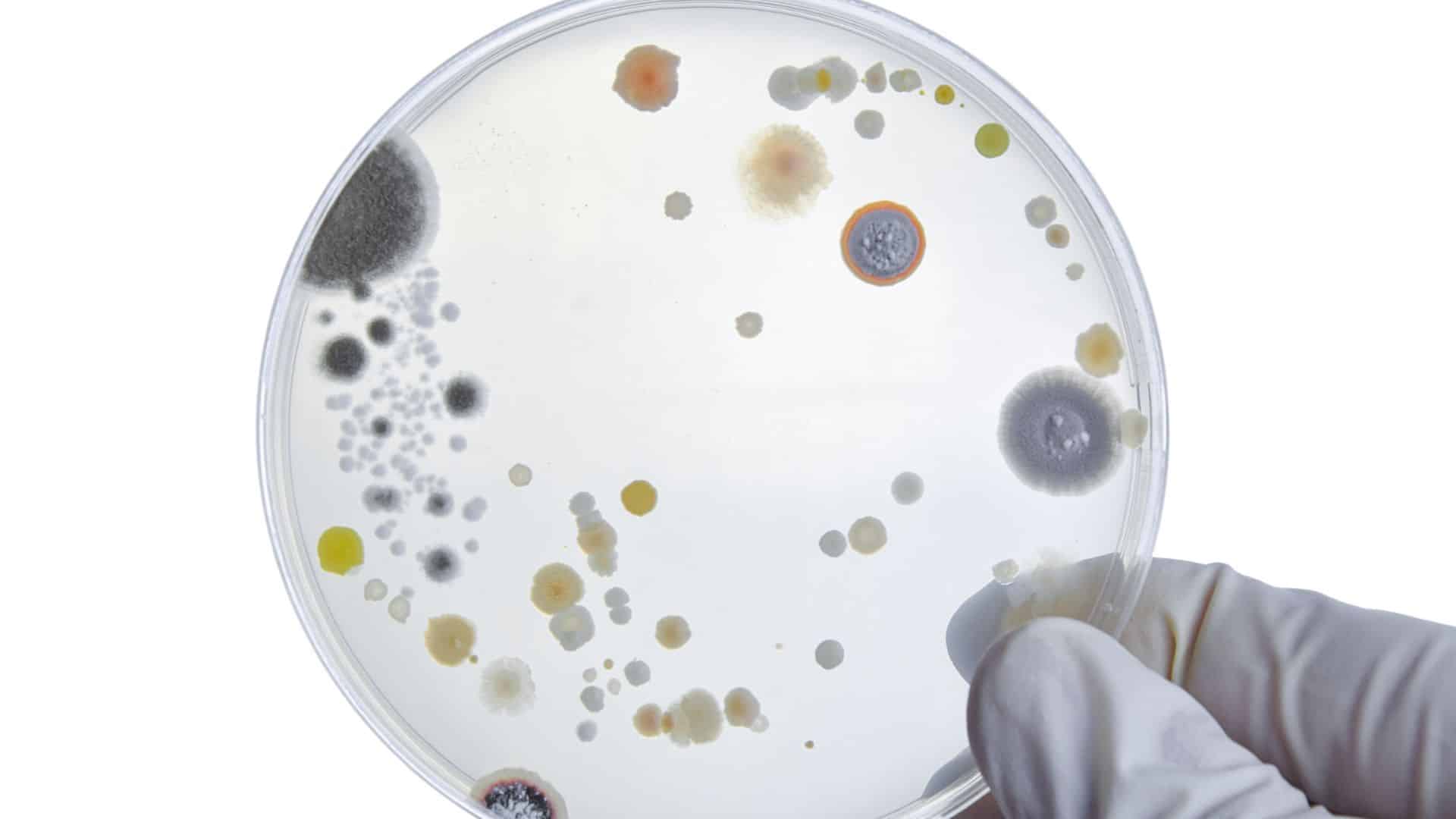 Bacteria on a petri dish