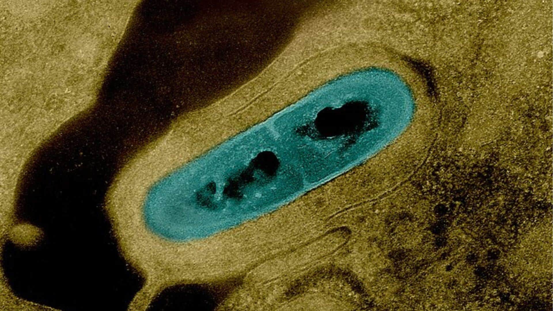 A micrograph of Listeria Bacterium in tissue