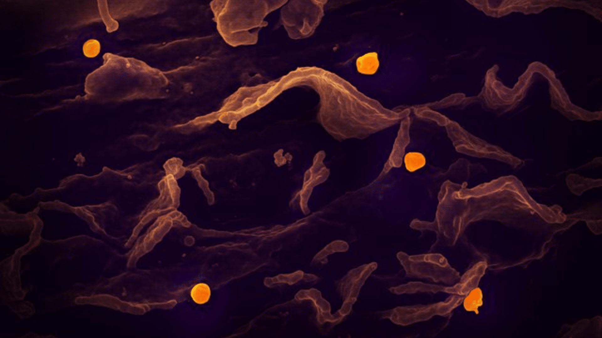 microscopic Nipah virus structure