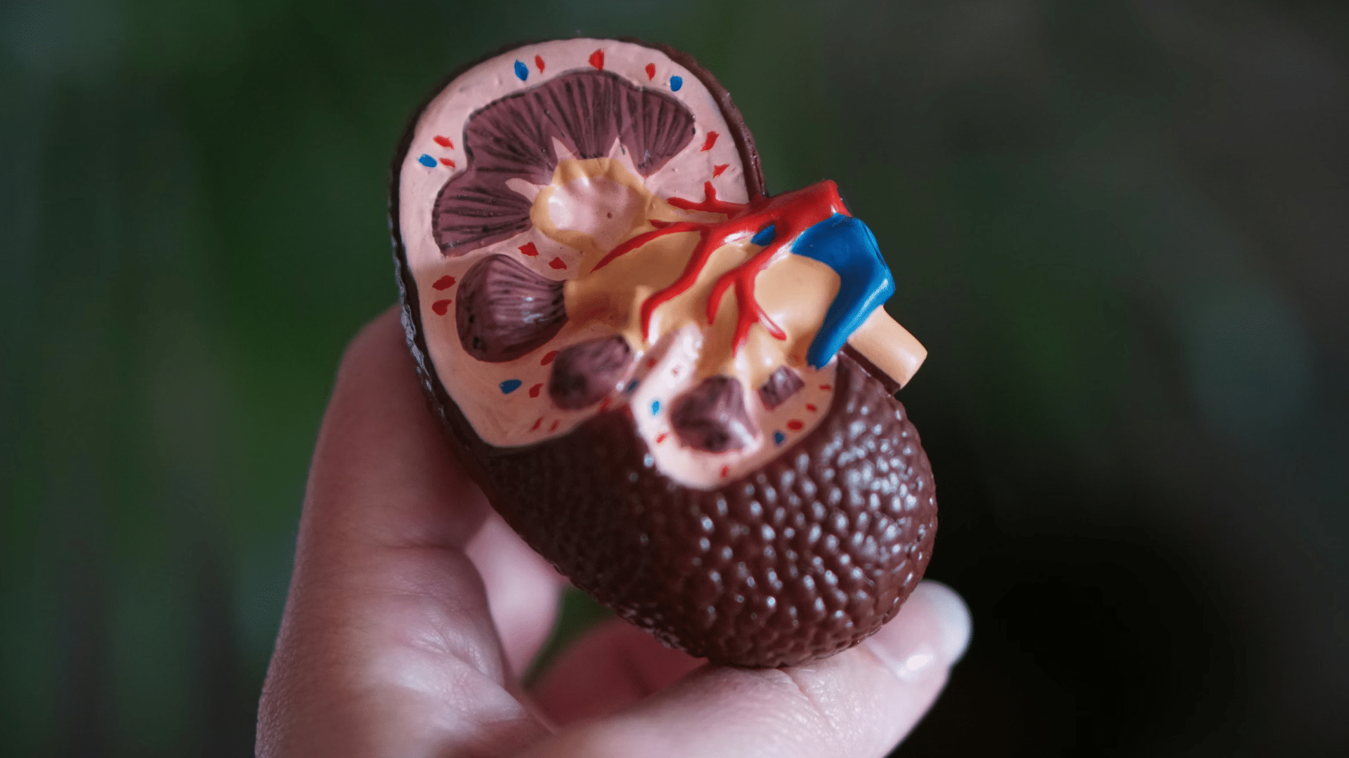 kidney model