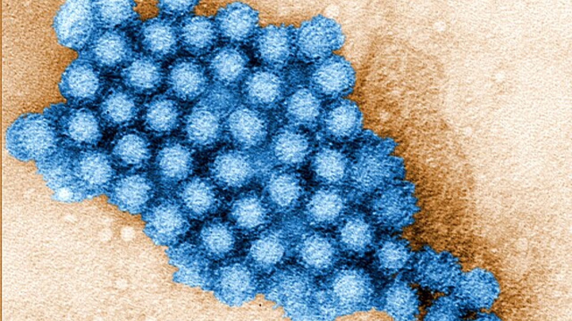 Microscopic view showing a cluster of small, blue, spherical norovirus particles.