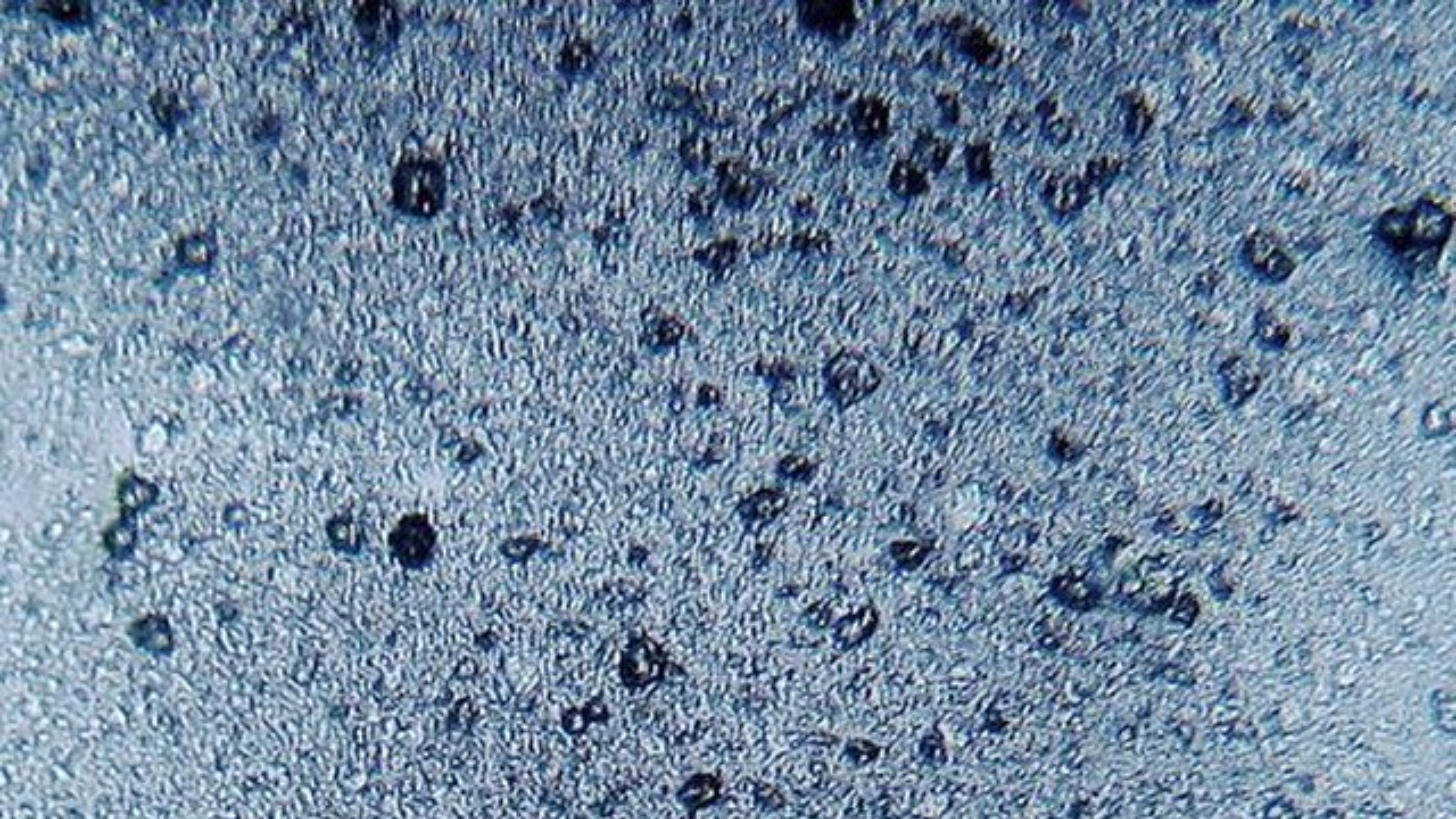 Microscope view of microplastics.