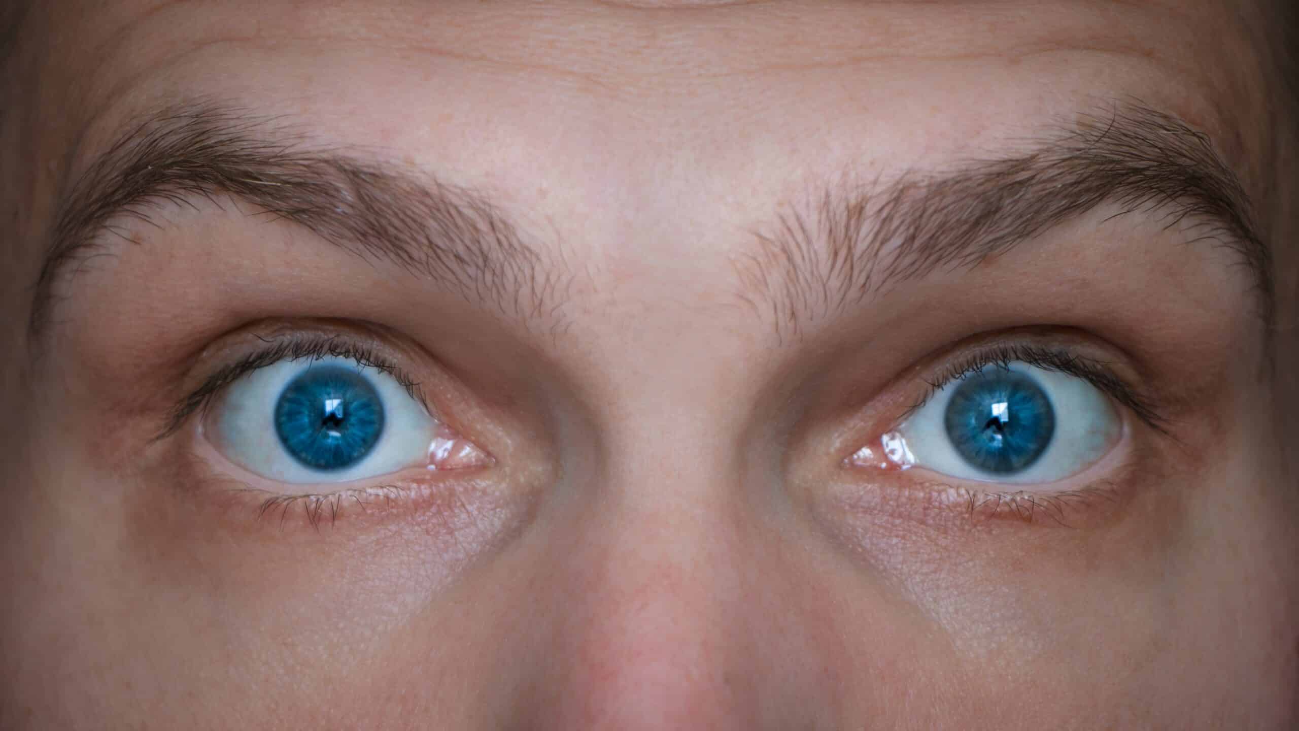 Person raising eyebrows close up.